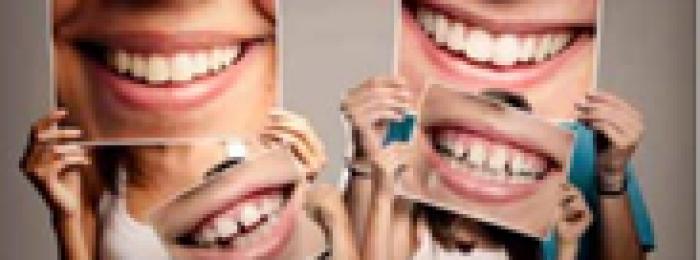 Kat Michaels, Deputy Head of Teaching at Tempdent explores the impact of a beautiful smile in Issue 7 of Modern Dentist Magazine