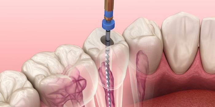 Clinical CPD Module 8 – Endodontics